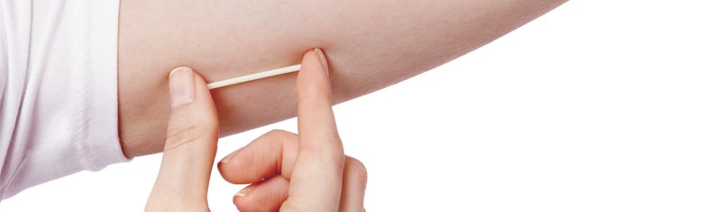 Implante Contraceptivo: Descubra esse método